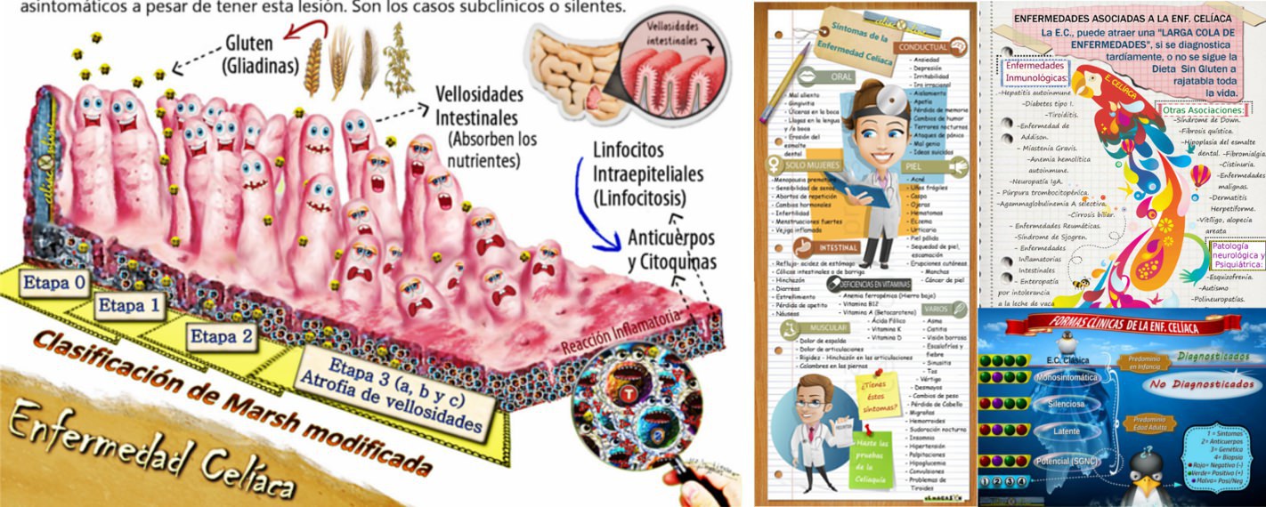 La Enfermedad Celiaca